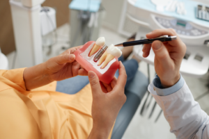 a closeup of a dental implant model